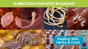 Eliminating and Treating Parasites in humans naturally withs foods and herbal medicine