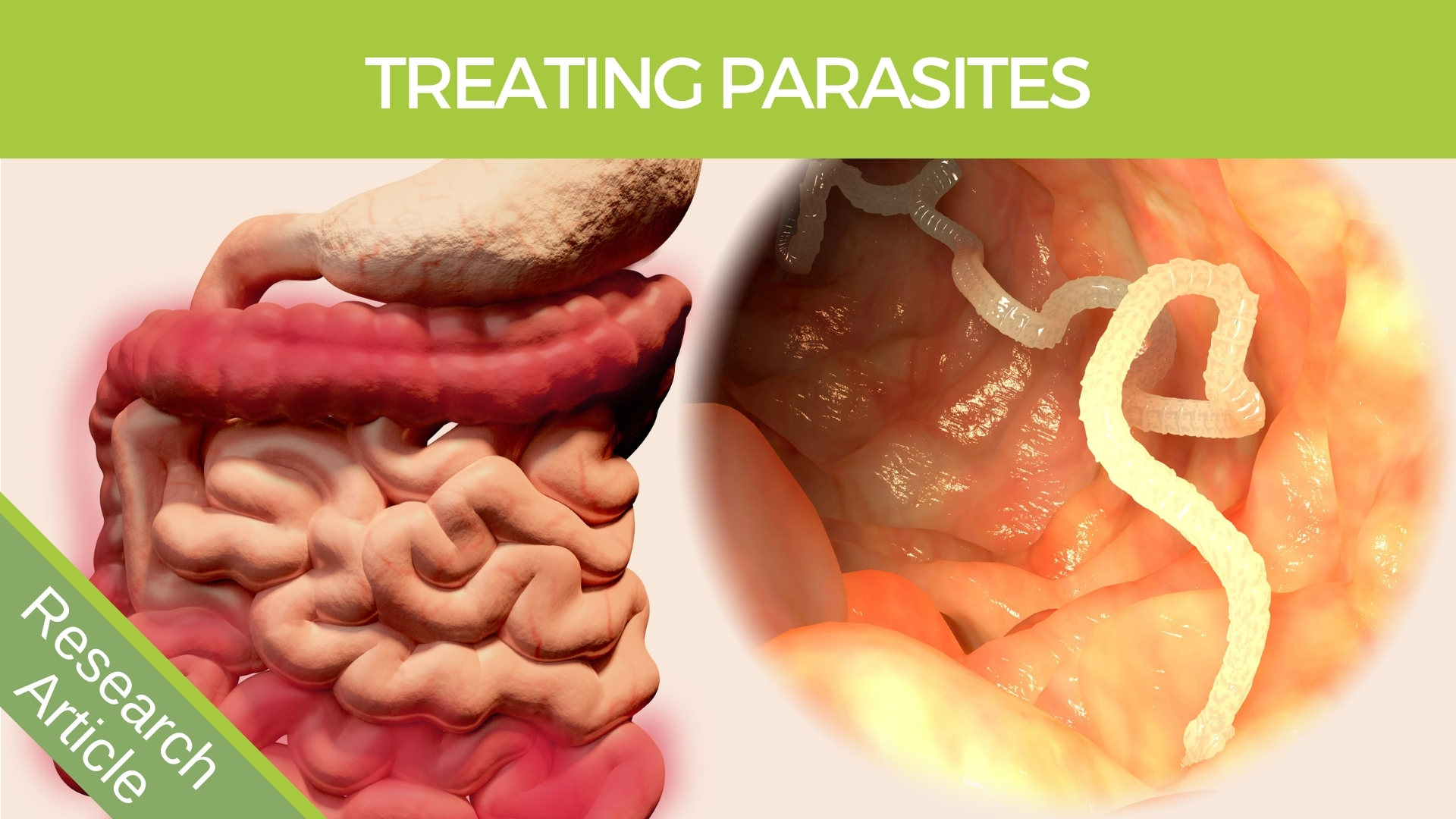 Treating Parasites