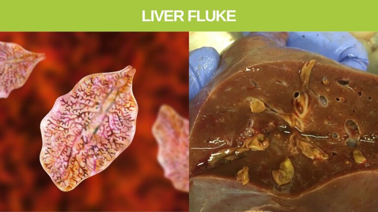 liver fluke parasite in humans
